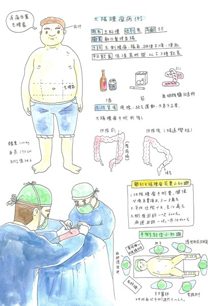 呂佩珊-揭露大腸腫瘤2
