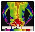 紅外線熱影像圖片下背痛情況