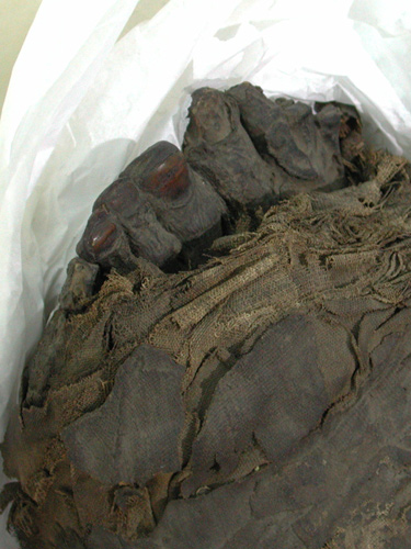 Looking at the feet, the foot-case has been removed but the toenails are intact and can be clearly seen.