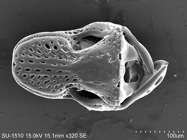 口鰓海膽的蛇首叉棘SEM，放大320x。